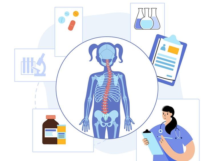 Scoliosis