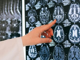 How Pakistan’s study shed light on Kerala’s rare brain-eating amoeba case in infant