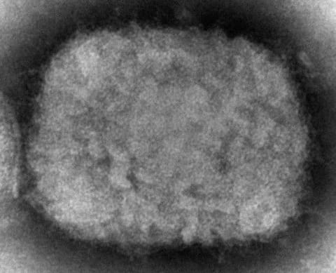 This electron microscope image made available by the Centers for Disease Control and Prevention shows a monkeypox virion, obtained from a sample associated with the prairie dog outbreak.  