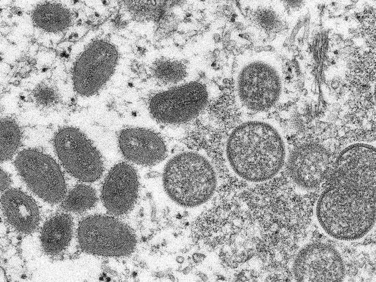 STOCK Monkeypox_07235