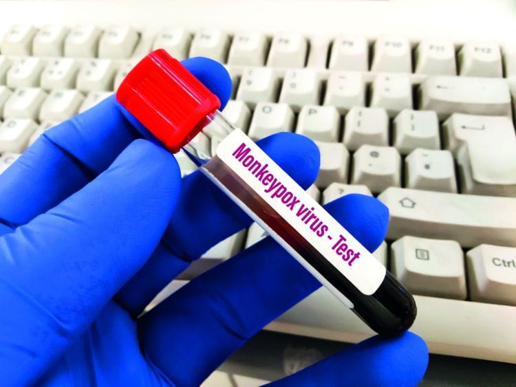shutterstock FTC Monkey pox321-1653399679054