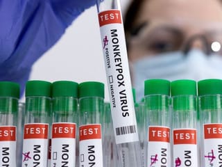 Health agency confirms community spread of monkeypox in England