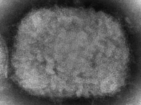 A 2003 electron microscope image made available by the US's Centers for Disease Control and Prevention shows a monkeypox virion.