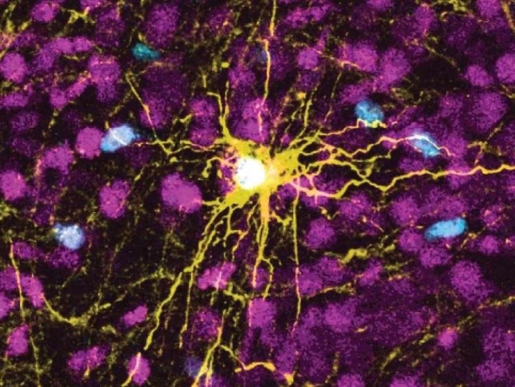 human astrocyte cell