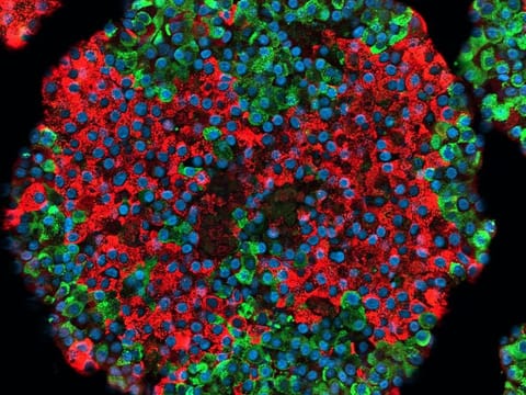  Picture of a stem cell-derived pancreatic islet. Insulin-producing cells are in red while glucagon-producing cells are in green
