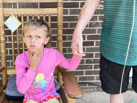 Kinsley White, 6, shows reporters a wound left on her face, Thursday, April 20, 2023 in Gastonia, North Carolina. 