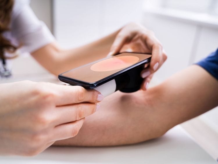 Prevention is far easier than many other forms of cancer.