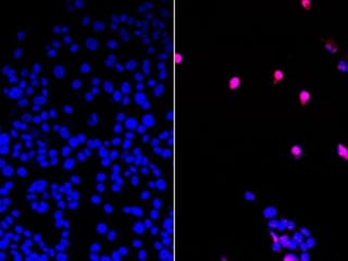 ‘Cancer-killing pill’ shows promise in pre-clinical tests