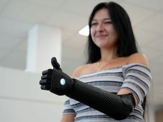 Photos: Limbless woman gets 3D-printed bionic arm