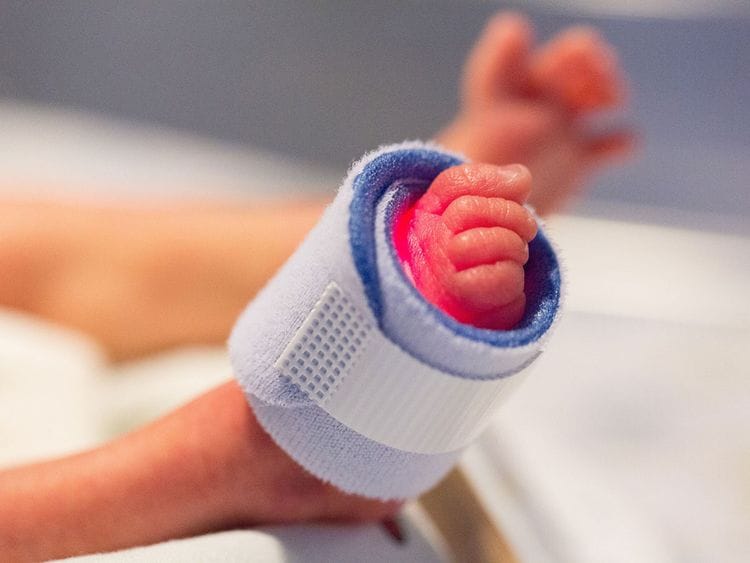 20230920 premature baby
