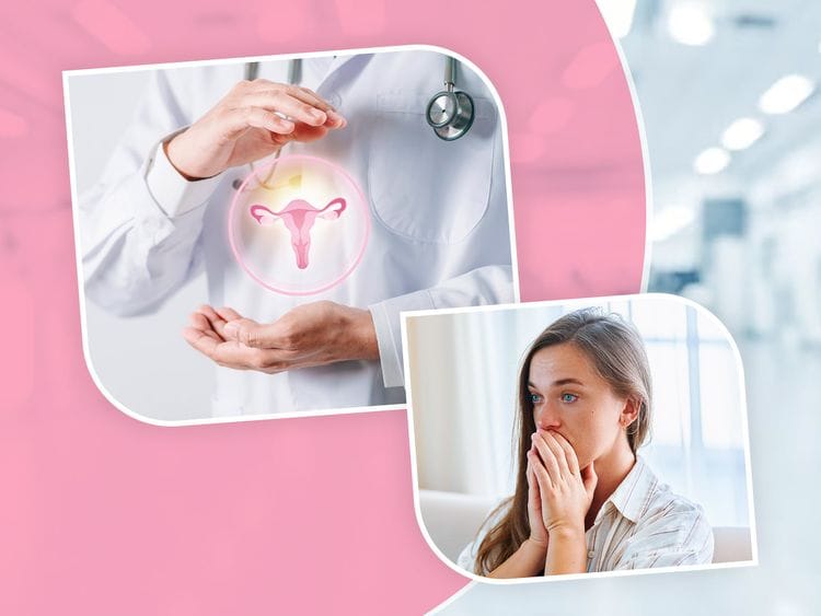 PCOS