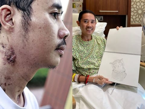 Alex Tugon, 37, a Filipino expat worker, had a complete lung failure. He is grateful for his second lease on life after undergoing a double lung transplant in the UAE.