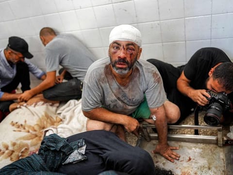  An injured man looks on as behind him a photojournalist documents the scene at a morgue holding the bodies of people killed in the aftermath of overnight Israeli bombardment in Al Maghazi in the central Gaza Strip, at Al Aqsa Martyrs hospital in Deir Al Balah on June 25, 2024.