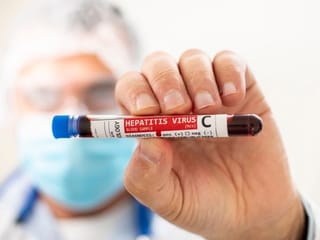Should you get tested for Hepatitis C? Dubai Health Authority issues guidelines