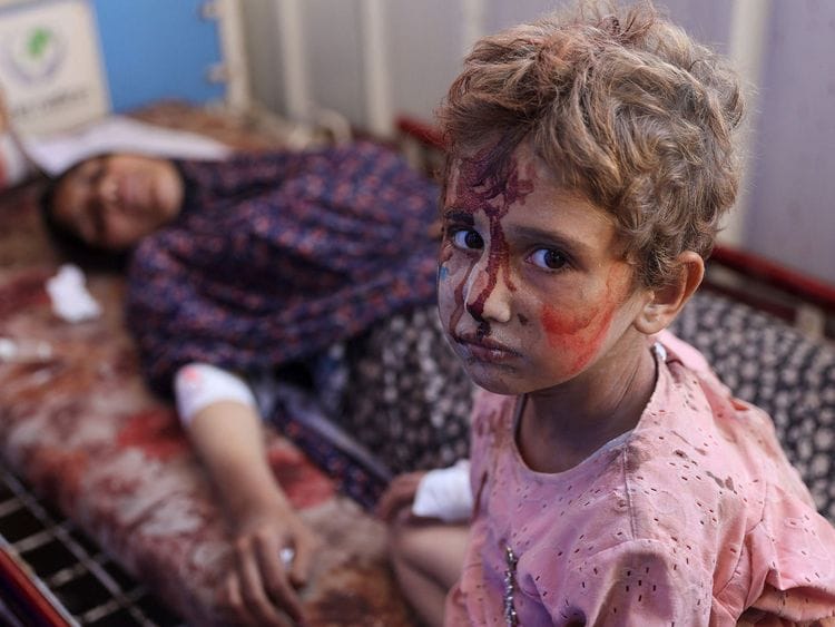 An injured child sits next to a woman at Al Ahli Arab hospital, also known as the Baptist hospital in Gaza City following Israeli bombardment on the Hassan Salameh and Al Nassr schools housing displaced Palestinians on August 4, 2024.