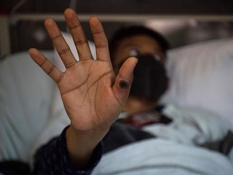 Pakistan is conducting genetic sequencing to determine the variant of the latest case.