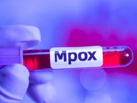 Clade 1b causes death in about 3.6 percent of cases, with children more at risk, according to the WHO.