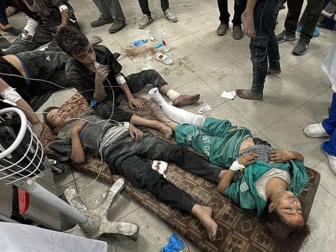  Wounded Palestinians receive treatment at the Kamal Adwan Hospital after an Israeli airstrike in Beit Lahia, in the northern Gaza Strip on October 19, 2024, amid the ongoing conflict between Israel and the Palestinian Hamas militant group. (Photo by Islam AHMED / AFP)